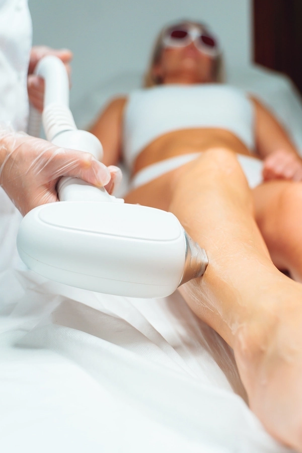 Epilation au laser diode 