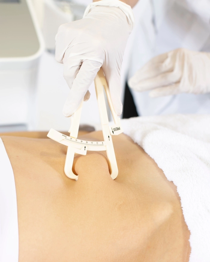 cryolipolyse, minceur par le froid