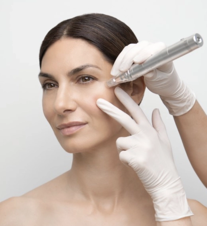 Microstimulation / Microneedling