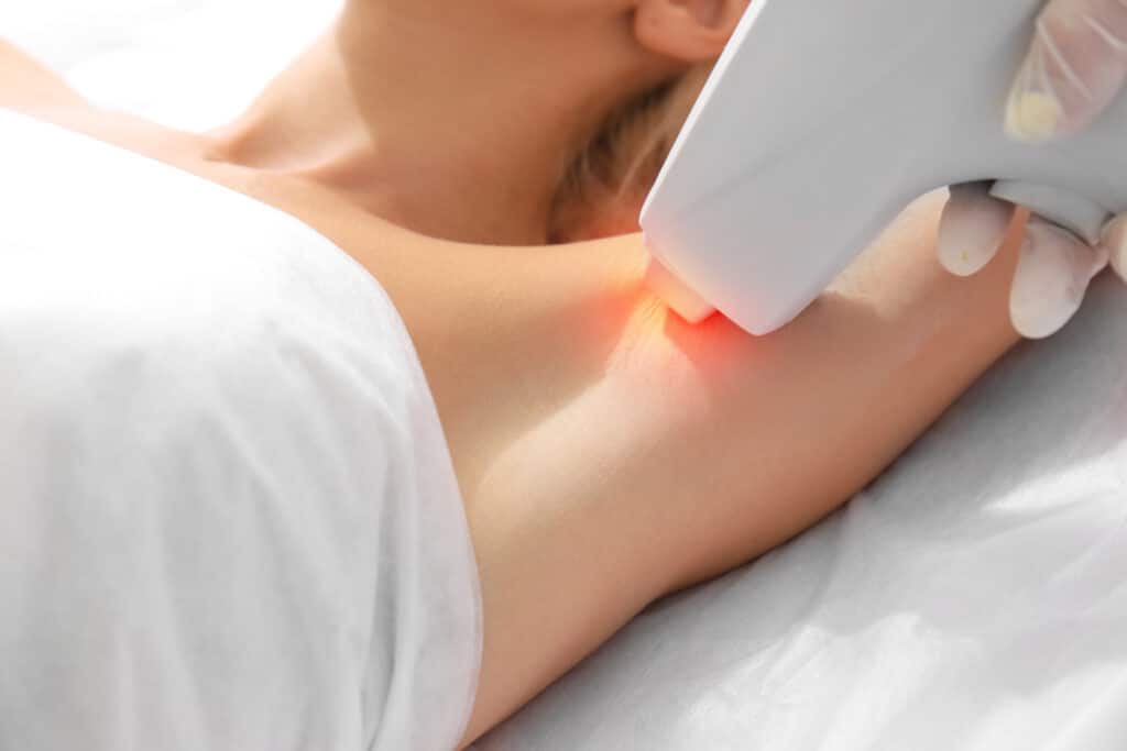 Épilation Laser Aisselle : Séance de Lumière Pulsée Opératrice en gant blanc appliquant un traitement laser (lumière rouge visible) sur l'aisselle d'une cliente allongée sous un drap blanc.